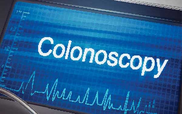 Colonoscopy