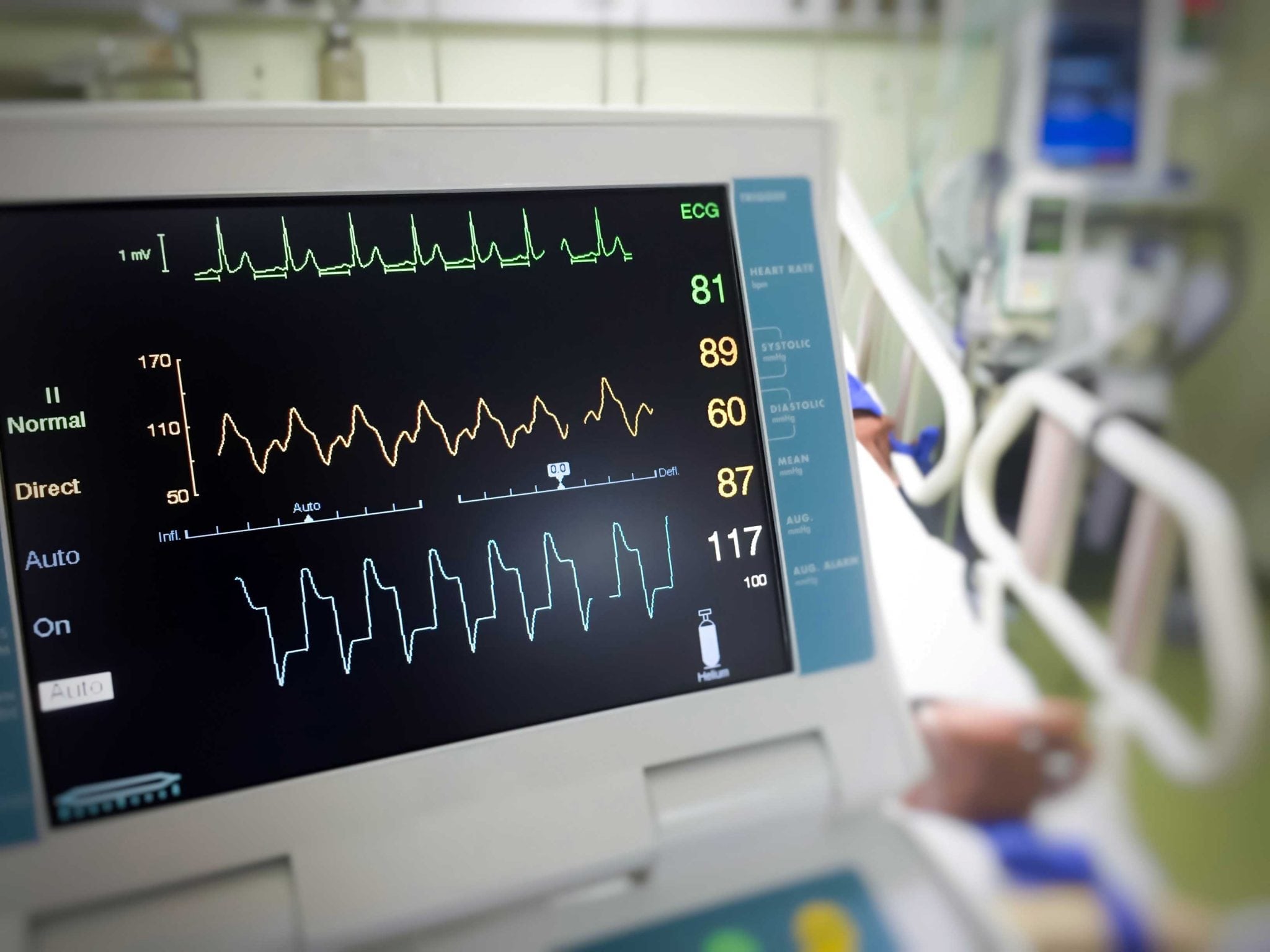 An EKG machine.