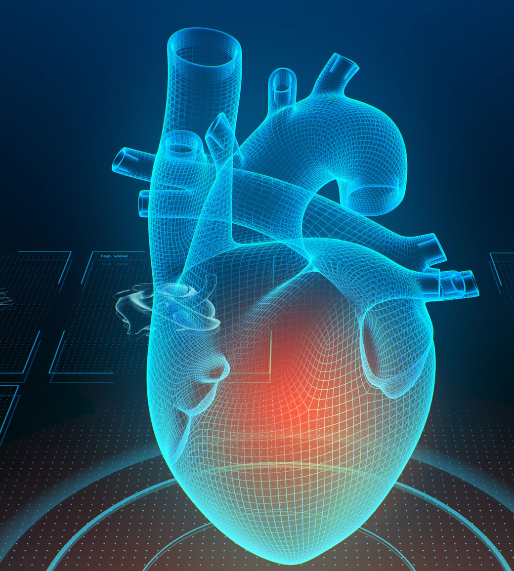 Coronary calcium score.