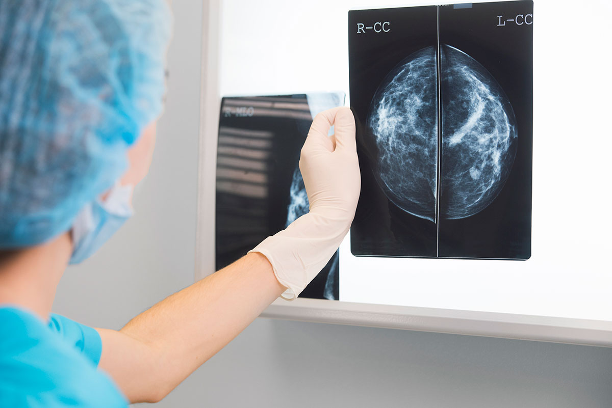 Breast Cancer Surgery
