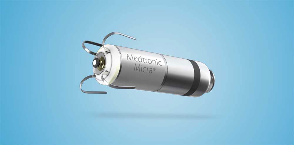 Tiny Pacemaker