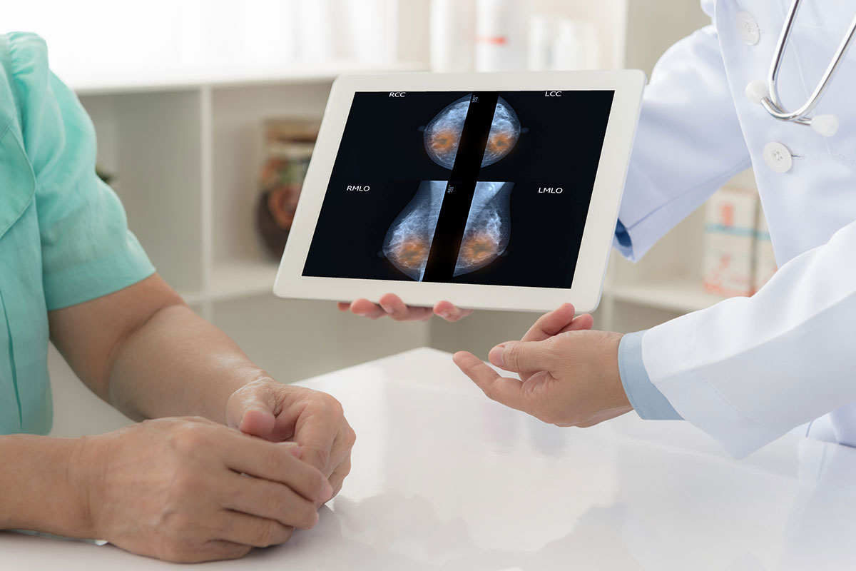 Mammography