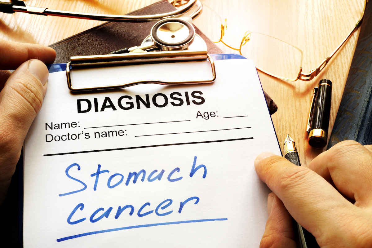 Stomach Cancer