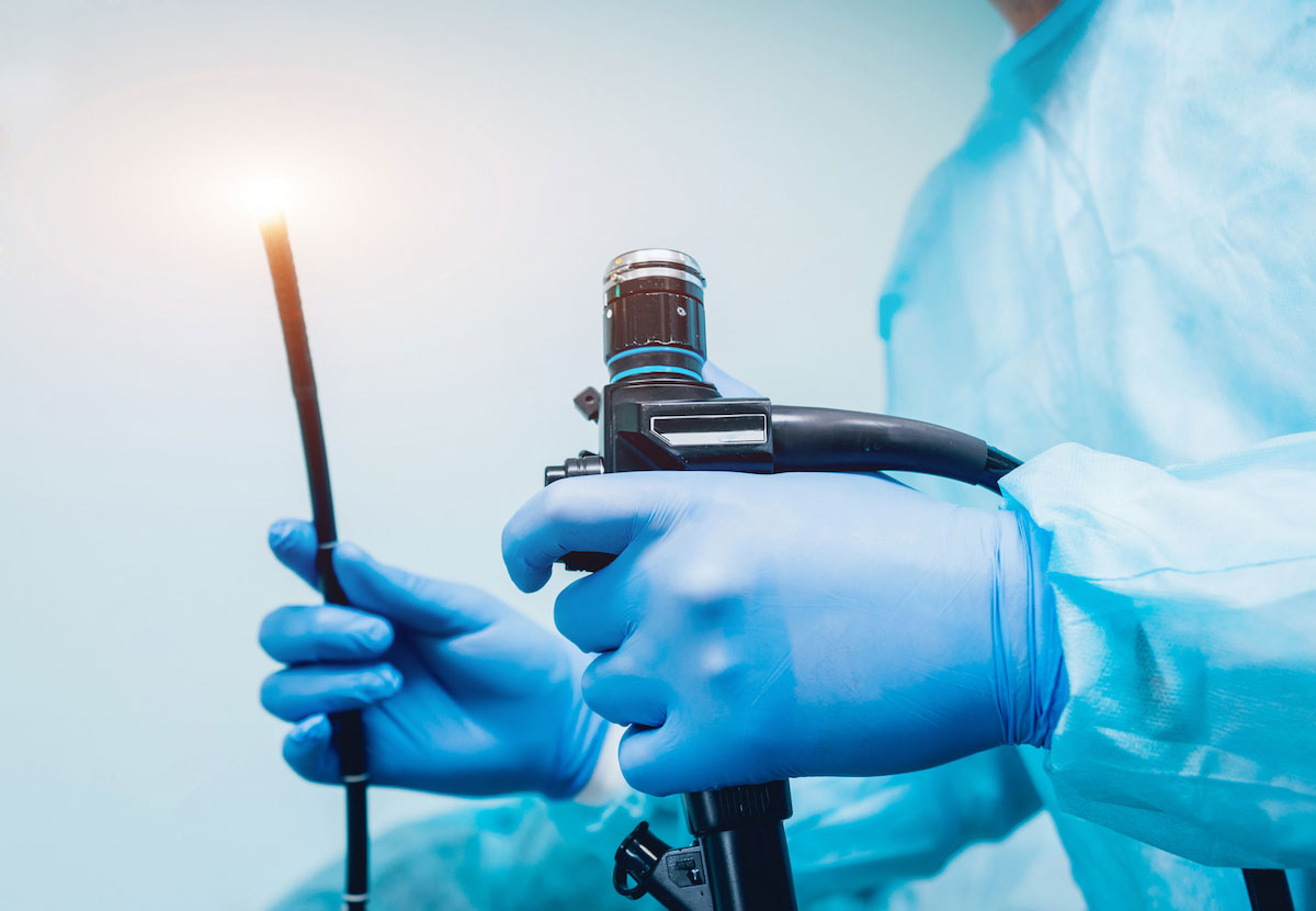 Upper GI Endoscopy