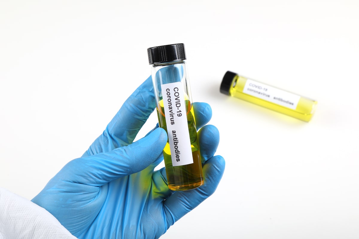 Antibody Test