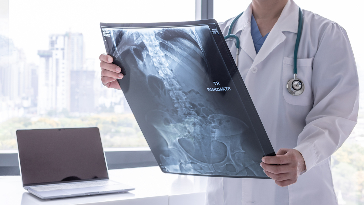 Upper GI cancer