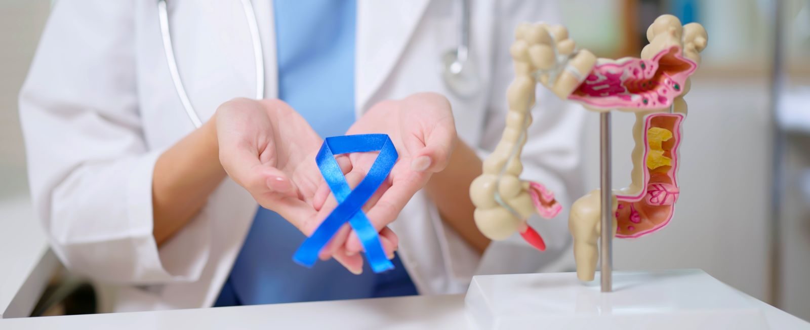 People with inflammatory bowel disease (IBD) such as Crohn's or ulcerative colitis are at twice the risk of developing colon cancer.