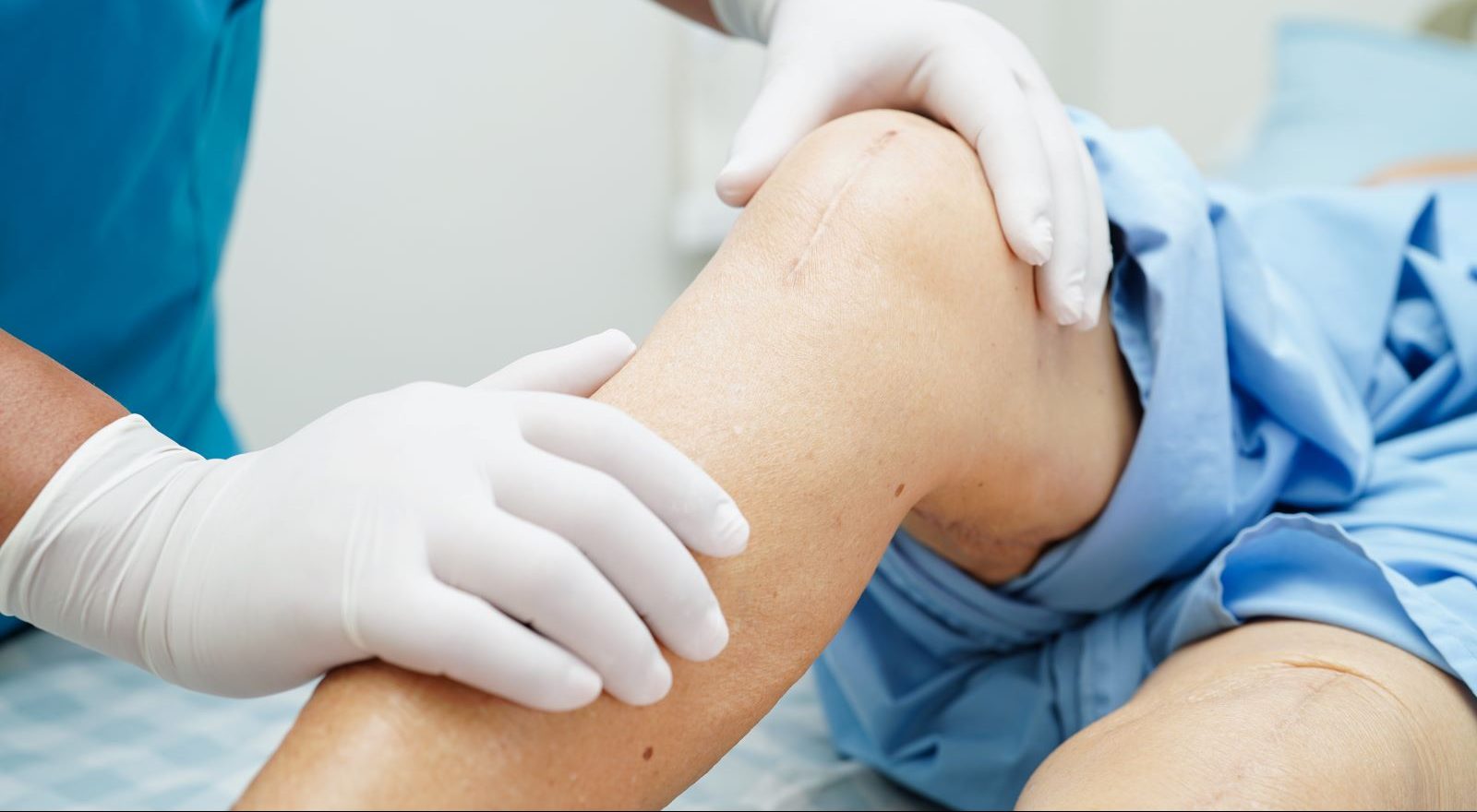 Make these five lifestyle changes before your hip or knee replacement to make sure your recovery goes smoothly - and quickly.