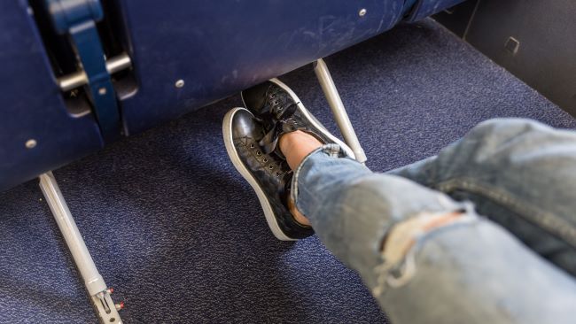 swollen feet flying