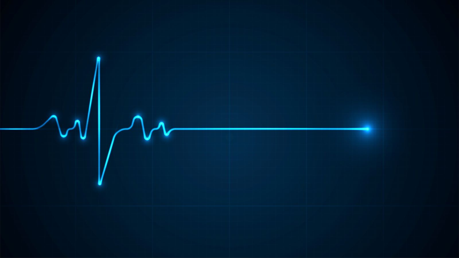 In the coming years, cases of atrial fibrillation (AFib) are expected to soar. What are the most common causes of AFib?