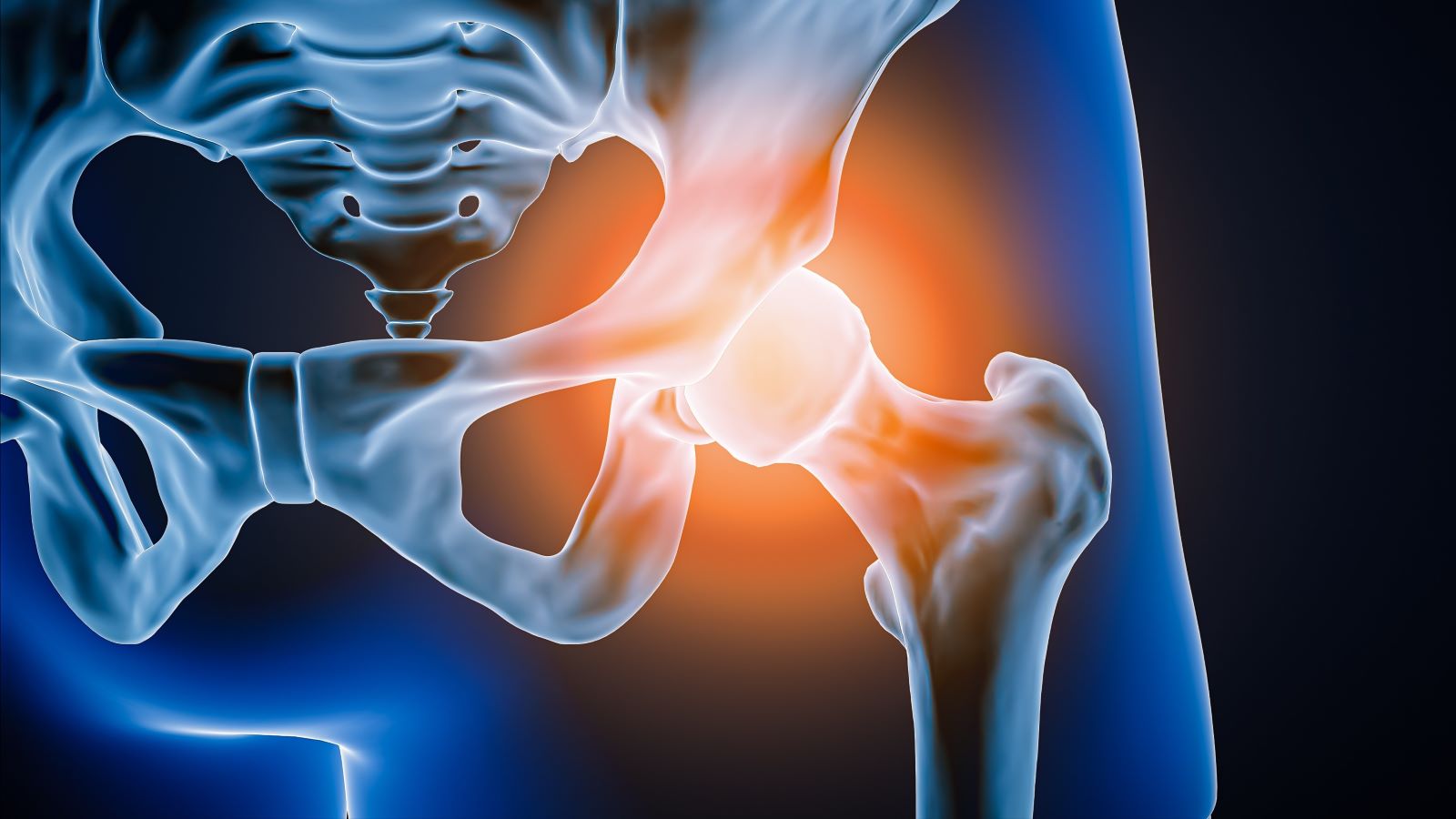 To help you have the most successful recovery possible, our expert shares advice on what not to do after hip replacement surgery.
