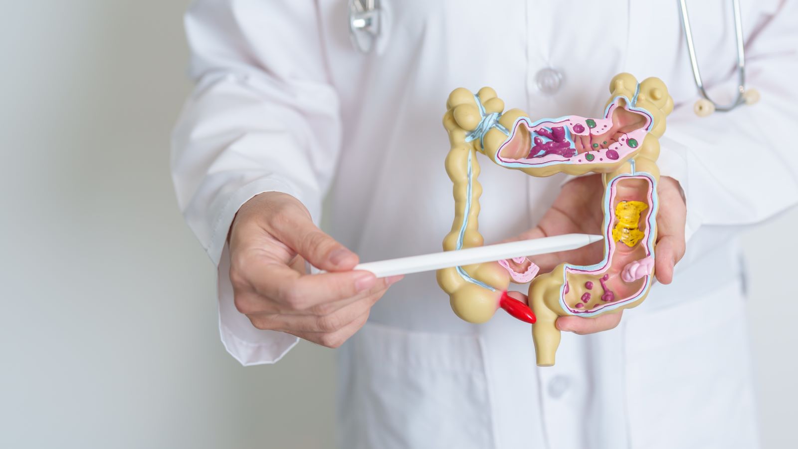 Your colonoscopy might not be the most exciting event on your calendar - but these four tips can make your colonoscopy prep more bearable.