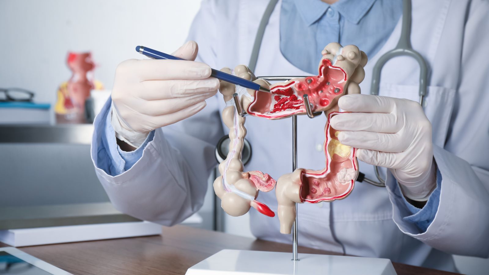 If you're dreading your next colonoscopy, you might be wondering about other options to screen for colon cancer.