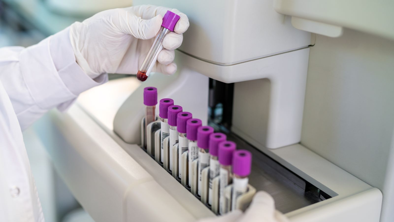 To understand your bloodwork results, take “normal” ranges with a grain of salt, and think of your provider as your translator.