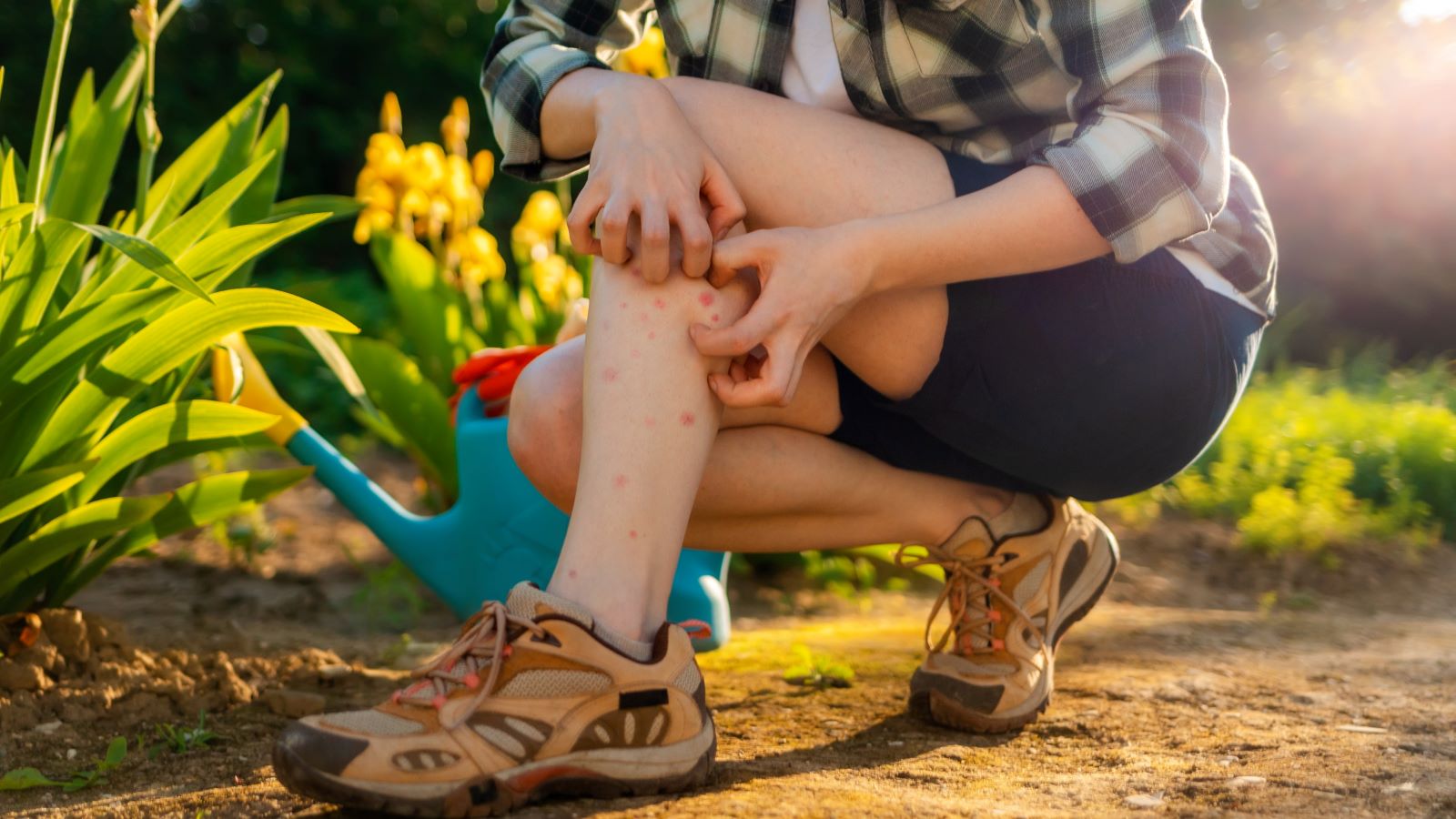 summer skin rashes