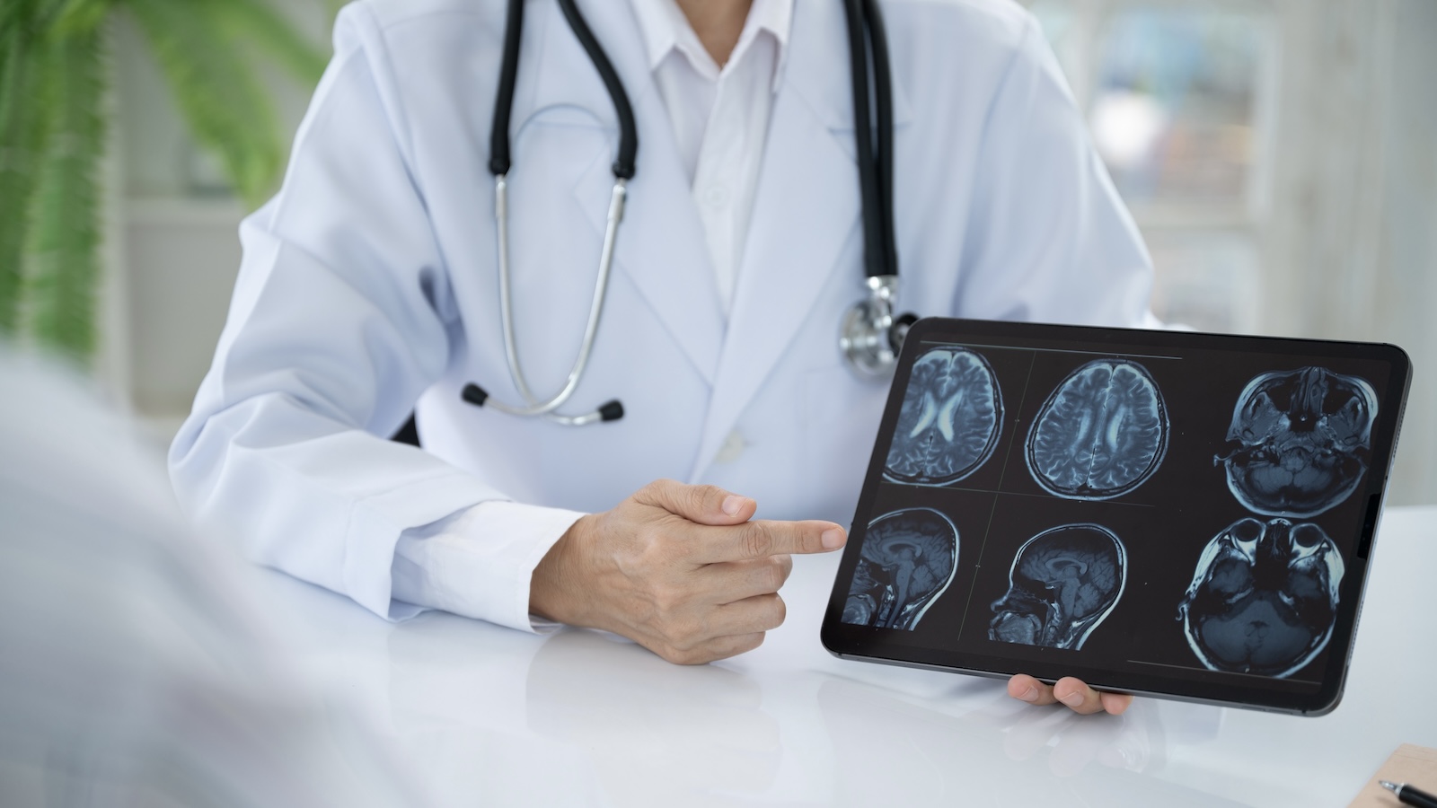 Can You Actually Cure Epilepsy?